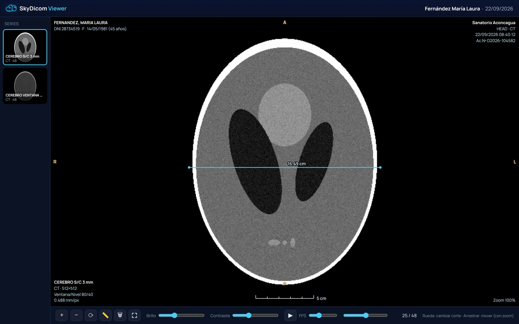 SkyDicom Viewer con una serie de tomografía de prueba